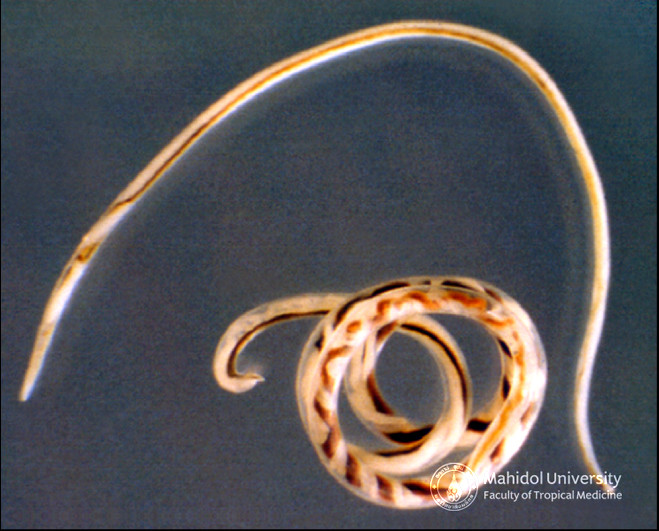 ???????????? (???????????)