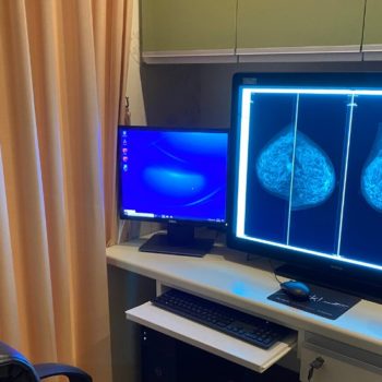 mammogram