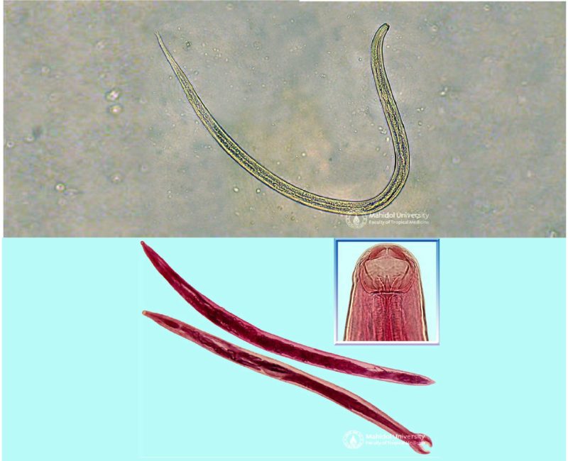 เส้นด้าย - ปากขอ